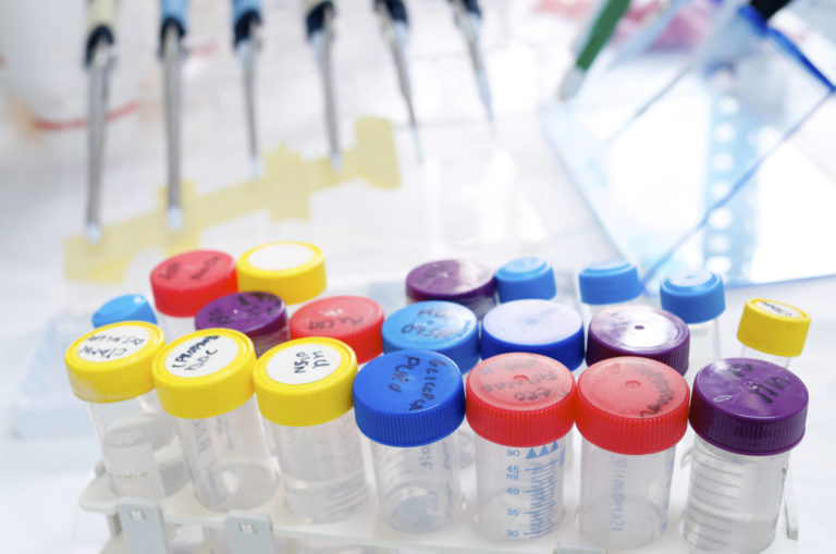 Drug & Alcohol Screening The Work Clinic Accurate Results